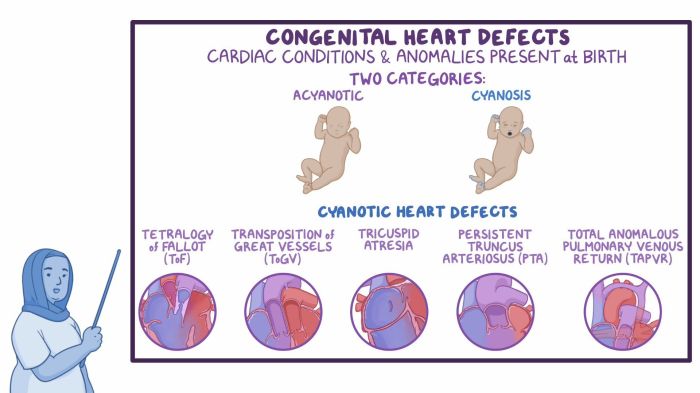 Congenital heart disease nclex questions